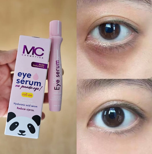 Serum Roll on Para El Contorno De Ojos |Mirada Lumi ®.