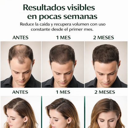 Dermacapil ®